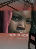 Enfants du Noma